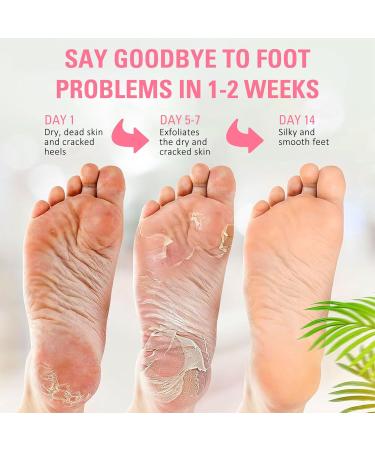 Rose Foot Peel Mask For Hard Skin Rose Foot Peel Mask Rose Foot Mask Exfoliating Feet Peeling Socks Foot Care Mask Plant Formula Moisturising Socks Foot Spa Fits for Women and Men(2 Pairs) - Buy Online on GoSupps.com