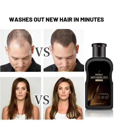 Ginger Shampoo Ginger Hair Regrowth Shampoo Anti Hair Loss Ginger Shampoo Natural Organic Ginger Shampoo Trophoblastic Hair Promote Hair Growth Smooth Anti Dandruff & Anti itching 200ML - Buy Online on GoSupps.com