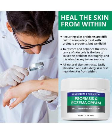 Hermon Psoriasis Eczema Relief Cream: Maximum Strength for Psoriasis Eczema - Relieve Symptom of Resistant Effective for Seborrheic Dermatitis Folliculitis 100m 3.4 Fl Oz (Pack of 1) - Buy Online on GoSupps.com