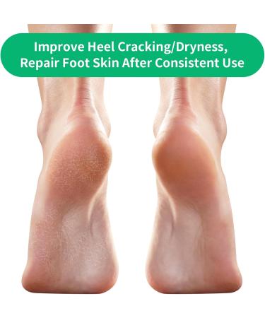 Shop Ohtomber Cracked Heel Treatment Repair Socks - 5 Pairs Moisturizing Gel Socks for Dry Feet & Heels - Toeless Foot Care for Silky Soft Skin - Buy Online on GoSupps.com
