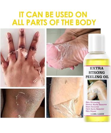 Yellow Peeling Oil Peeling Oil for Dark Skin Strong Peeling Oil Extra Strength Exfoliating Peeling Solution for Body All Skin Type - 110ML/3.66 OZ (2 PCS) - Buy Online on GoSupps.com