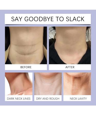  homomdy Firming neck cream firming and lifting neck cream with double roller massage reduces wrinkles fine lines and double chin firms sagging skin lifting moisturizing - Buy Online on GoSupps.com