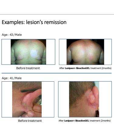  Lenipsor+ BioRelax Body and Hair Wash 30ml Helps treat psoriasis - Buy Online on GoSupps.com
