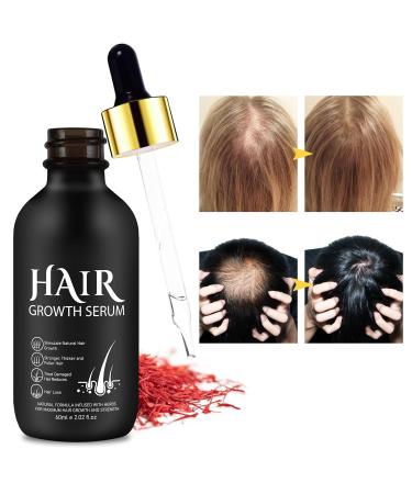 5% Minoxidil Hair Growth Serum - Biotin Oil for Men & Women | Thicker Healthier Hair Regrowth Treatment 2.02 oz - Buy Online on GoSupps.com