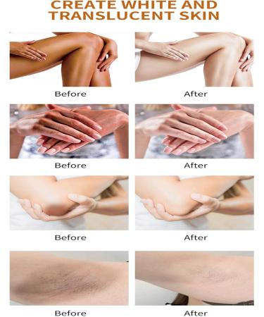 Dark Spot Corrector Cream for Face and Body - Skin Lightening Cream Intimate Areas for Armpits Knees Elbows Legs Inner Thigh - Buy Online on GoSupps.com