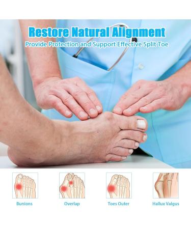 Bunion Corrector with Gel Pads - Toe Straightener Splint for Hammer Toes & Hallux Valgus - Buy Online on GoSupps.com