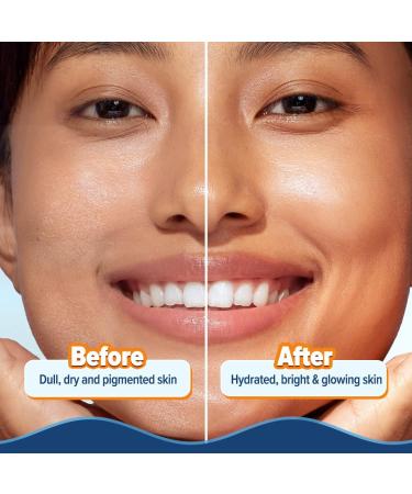 Aqualogica Glow+ Hydra Gel Moisturizer with Vitamin C & Papaya | 24-Hour Hydration for Glowing Skin | Quick Absorbing | 200g (7.1 Oz) - Best International Shipping - Buy Online on GoSupps.com