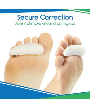 ViveSole Toe Separator For Bunion - Hammer Toe Straightener Pads (Pair) -Corrector for Curled  Crooked  Curved  Overlapping  Clubbed  Claw  Mallet Curling Relief-Right & Left Gel Support Crest Cushion - Buy Online on GoSupps.com