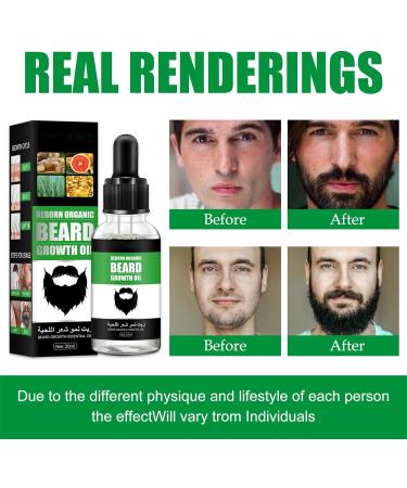 Beard Growth Kit with 0.5mm Derma Roller and Beard Oil Serum for Men - Grooming and Rapid Growth Solution (Type2) - Buy Online on GoSupps.com