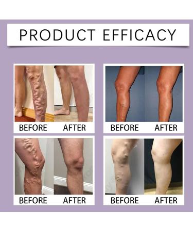 Cr me pour les Jambes et Pieds | Cr me Circulation Jambes 50g - Gel P n trant Pour Peau S che Maison Voyage Soin Talons - Buy Online on GoSupps.com