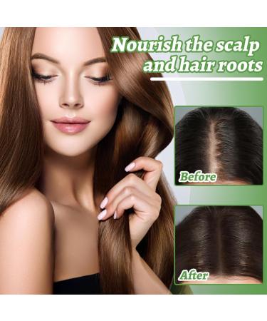 Teegxddy 2 pieces hair growth for men and women accelerates care solution prevents hair loss stimulates beard growth soft universal skin structure 30 ml - Buy Online on GoSupps.com