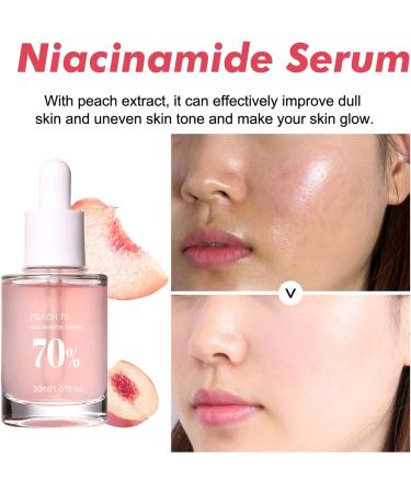 Peach 70 Niacin Serum 70% Peach Niacinamide Serum Hydrating Face Serum Daily Clean Beauty Skincare Face Serum for Women(30ml) - Buy Online on GoSupps.com