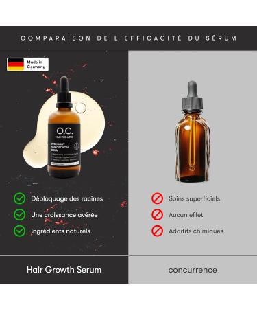 Overnight Hair Growth S rum - S rum capillaire en cas de chute de cheveux - Avec romarin panth nol et aloe vera - Favorise la croissance des cheveux - Alternative naturelle au minoxidil - Buy Online on GoSupps.com