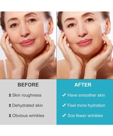 Forehead Face Wrinkle Patches - 256 Silicone Skincare Pads for Smoothing Frown Lines & Reducing Fine Lines Overnight - Buy Online on GoSupps.com
