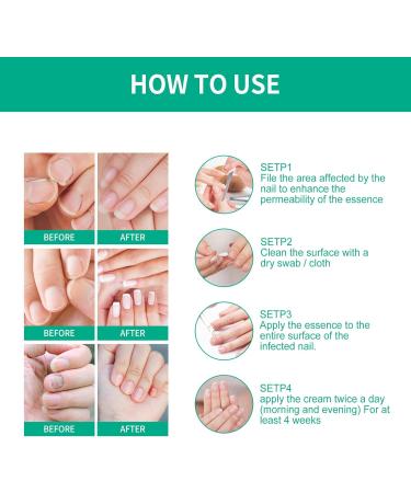 dhcprj Kerassentials Toenail Fungus Treatment Oil Toenail & Nail Care Solution Safe & Effective Repairs & Renewals Easy to Use Yellow Liquid - Buy Online on GoSupps.com