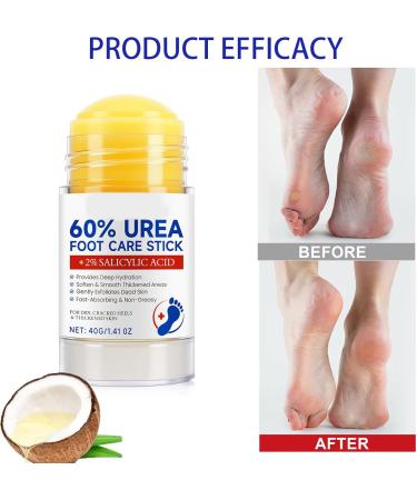 Hand and foot cream with 60% urea and 2% salicylic acid to repair cracked heels dry and rough skin - Intense moisturizing care for hands elbows and feet (2 pcs) - Buy Online on GoSupps.com
