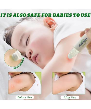 Ekukeon Antiitch Rollon for mosquito bites 100 natural with arnica and pine oil mosquito bite stick to soothe itching and redness 10 ml - Buy Online on GoSupps.com