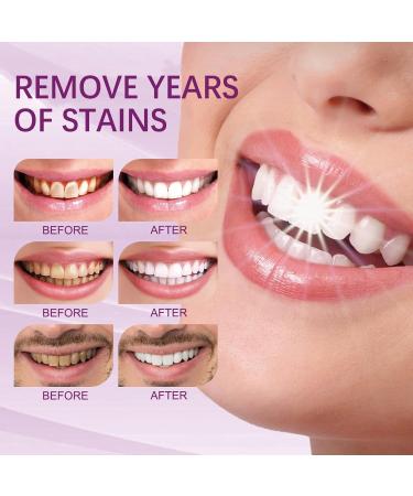 KLYso Professional Teeth Whitening Toothpaste for Stain Removal & Oral Care(3PCS) - Buy Online on GoSupps.com