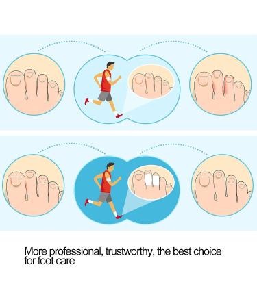 Silicone Toe Separator 8Pairs - Bunion Corrector & Pain Relief - White Toe Sleeves - Buy Online on GoSupps.com