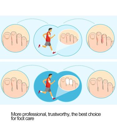 Toe Separator & Bunion Corrector - 8 Pairs Silicone Toe Protectors for Men & Women | Pain Relief & Big Toe Alignment - Buy Online on GoSupps.com