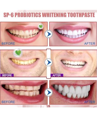 Thefirstplace Toothpaste Ultra Whitening Toothpaste Sp6 Anti-Stain and Whitening Toothpaste Probiotic Sp-6 Deep Cleaning Care Toothpaste Sp-6 Management (3PC) - Buy Online on GoSupps.com