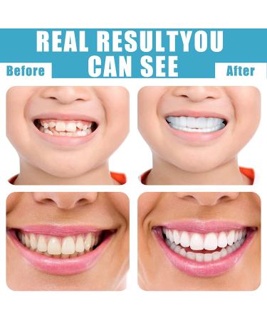 4 Set Fake Teeth Veneers: Temporary Denture Snap in Teeth for Men and Women - Confidence Smile Dentures with Mini Tweezers - Bad Teeth Whitening Alternative - Buy Online on GoSupps.com