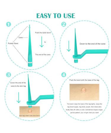 Skin Day Distant Micro Skin Tag Removal Kit - Efficiently Remove Small Skin Tags (4mm & Below) with 20 Ribbons & 72 Patches - Buy Online on GoSupps.com