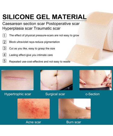 Silicone Scar Sheets 4 Pack for Surgery Scars Treatment - 5.7x1.57 Inch Tape Strips for Keloid, C-Section, Tummy Tuck, Stretch Marks - Surgical Scar Healing Cream Gel Patch Pad - Buy Online on GoSupps.com