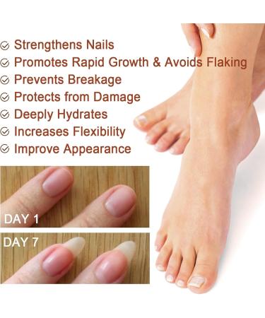 7 Days Nail Growth and Strengthening Serum Nail Serum for Strength and Growth Nail Repair Essence Serum Toenail Growth Treatment Restores The Healthy Natural Appearance of Nails - Buy Online on GoSupps.com