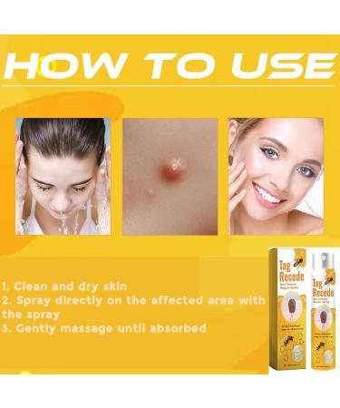 Tag Recede Bee Venom Treatment Spray - Effective Skin Tags Removal Spray (3 Pack) for Radiant Skin | Shop Internationally - Buy Online on GoSupps.com