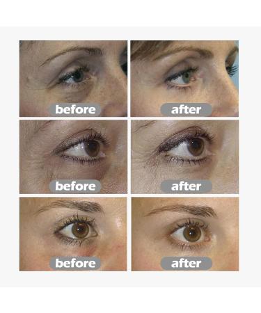  bellv Repairing eye cream for under the eyes and upper eyelid to hydrate | Firming nighttime eye cream moisturizing eye gel to eliminate under-eye puffiness - Buy Online on GoSupps.com