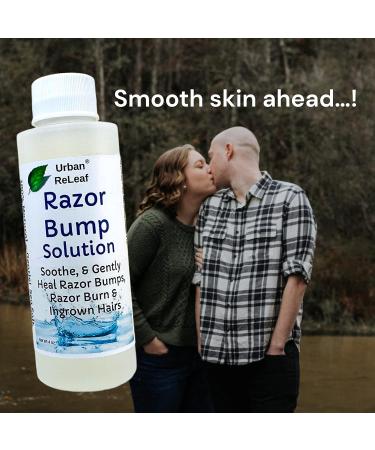 Urban ReLeaf Razor Bump Solution - Natural Sea Salt for Shaving Bumps & Ingrown Hairs - Made in USA - Buy Online on GoSupps.com