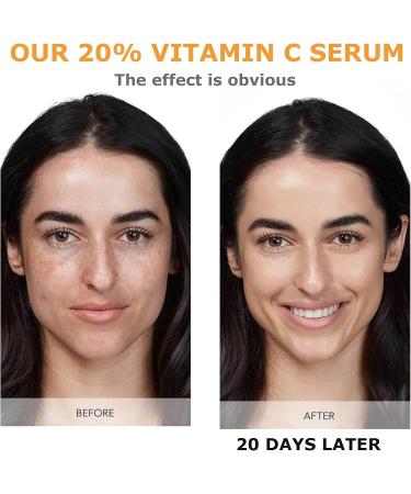 Vitamin C Serum For Face 20% Vitamin C Serum With Hyaluronic Acid For Collagen Boost Anti-Wrinkle Anti-Aging Dark Circle Sun Damage Brighten Hydrate Face Serum - Buy Online on GoSupps.com