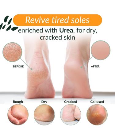 Tree to Tub Foot Cream - Non-Greasy Urea Lotion for Dry Cracked Heels & Feet | Nourishing Shea Cocoa Butter Foot Care | Perfect for Men & Women - Buy Online on GoSupps.com