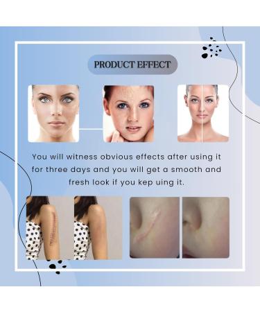 Scar Removal & Acne Cream | All-Natural Healing for Scars Spots & Pimples 1.7 fl oz - Buy Online on GoSupps.com