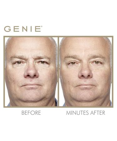 Genie Instant Line Smoother - Anti-Aging Serum (19 ml) | Instant Wrinkle Remover for Face | Reduce Fine Lines, Bags, and Wrinkles | 0.64 Fl Oz - Buy Online on GoSupps.com