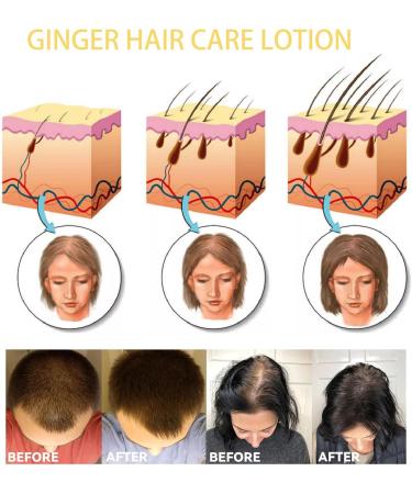 Ginger Hair Care Lotion Hair Growth Spray Ginger Hair Growth Oil Anti Hair Loss Trengthen Hair Roots Hair Care Lotion for Men and Women Thicken and Strengthen for Hair Regrowth - Buy Online on GoSupps.com