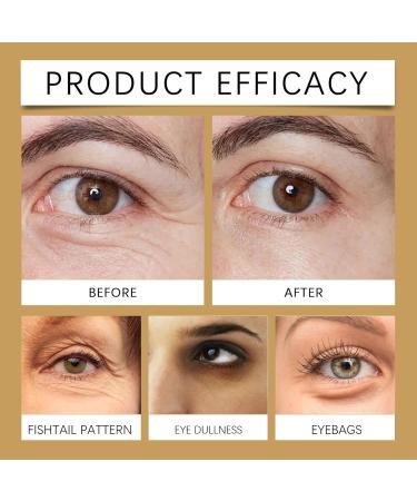 Eye Contour Serum with Hyaluronic Acid Anti-Wrinkle Eye Contour Caffeine and Niacinamide 15ml - Eye Contour Cream for Women - Anti-Dark Circles and Wrinkles Eye Cream (1pc) - Buy Online on GoSupps.com