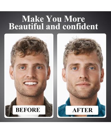 Akjaxqu 6-Piece Jawline Trainer | Silicone Jaw & Facial Muscle Trainer for Men & Women | Tone & Define Your Face - Buy Online on GoSupps.com