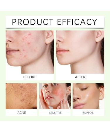 Hydrating Face Serum - Gentle Formula Balances Skin Microbiome Dual-Molecular Lock Moisture Easy Use For Daily & Pre-Makeup(1PCS) - Buy Online on GoSupps.com