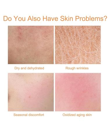 Pure Lanolin Cream for Very Dry Skin | Hydrating Organic Face Moisturizer for Women & Men - International Shipping Available - Buy Online on GoSupps.com