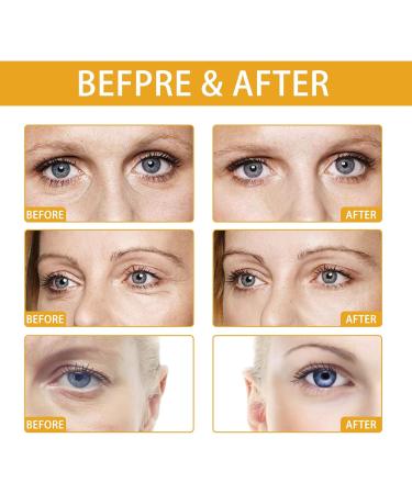 Rice Eye Cream For Dark Circles And Puffy Eyes Rice Eye Cream Anti Aging Eye Cream With Natural Rice Extract Brightens Under Eye Diminishing Deep Wrinkles Suitable For All Skin Types - Buy Online on GoSupps.com