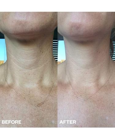 Neck Wrinkle Patch - Made in USA - 100% Medical Grade Silicone Patches - Anti Wrinkle Treatment for Firm Neck - Reduce Neck Rings - Buy Online on GoSupps.com