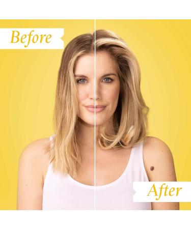 PHILIP KINGSLEY | Density Thickening Protein Spray | Volumizing Spray Treatment for Hair Loss and Fine Fragile and Damaged Hair | 4.05oz - Buy Online on GoSupps.com