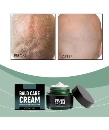 FLLUOUZH Bald Cream 50g Bald Head Moisturiser for Men Moisturizing Nourishing and Scalp Care Mens Shaving Cream with Matte Effect No Grease UV Protection 2 PCS - Buy Online on GoSupps.com