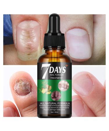Premium Ginger Cuticle Oil - Nail Strengthener & Turmeric Growth Serum for Damaged Nails | Nourishing Non-Sticky Formula - Buy Online on GoSupps.com
