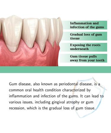 DentiZen Gum Regrowth Drops Gum Treatment for Receding Gums Rejuvenate Your Gums with Ease (1pcs) - Buy Online on GoSupps.com