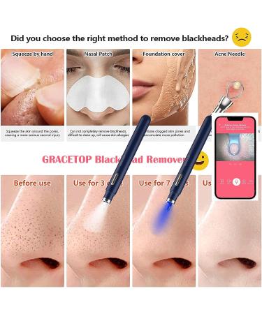 WiFi Blackhead Remover Camera with White/Blue Lights for iPhone & Android - Women's Gift (Navy Blue) - Buy Online on GoSupps.com
