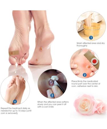 Mqupin Corn Removal Pads - Effective Wart Remover & Corn Treatment | 42PCs Foot Care Pain Relief Callus Remover - Buy Online on GoSupps.com