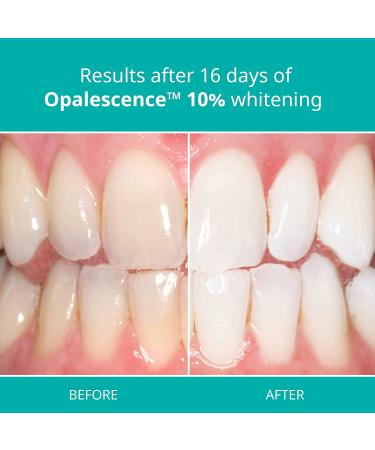 Opalescence 10% Teeth Whitening Gel Syringes - 8 Pack - Mint Flavor - Home Teeth Whitening Kit - Buy Online on GoSupps.com